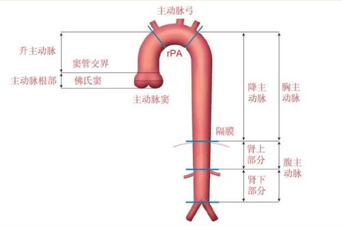 主动脉手术重疾险赔付需要满足什么条件？