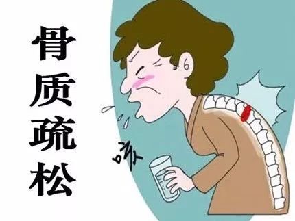 沉默的杀手——骨质疏松