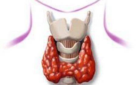 重疾险出险高发病种——甲状腺肿瘤