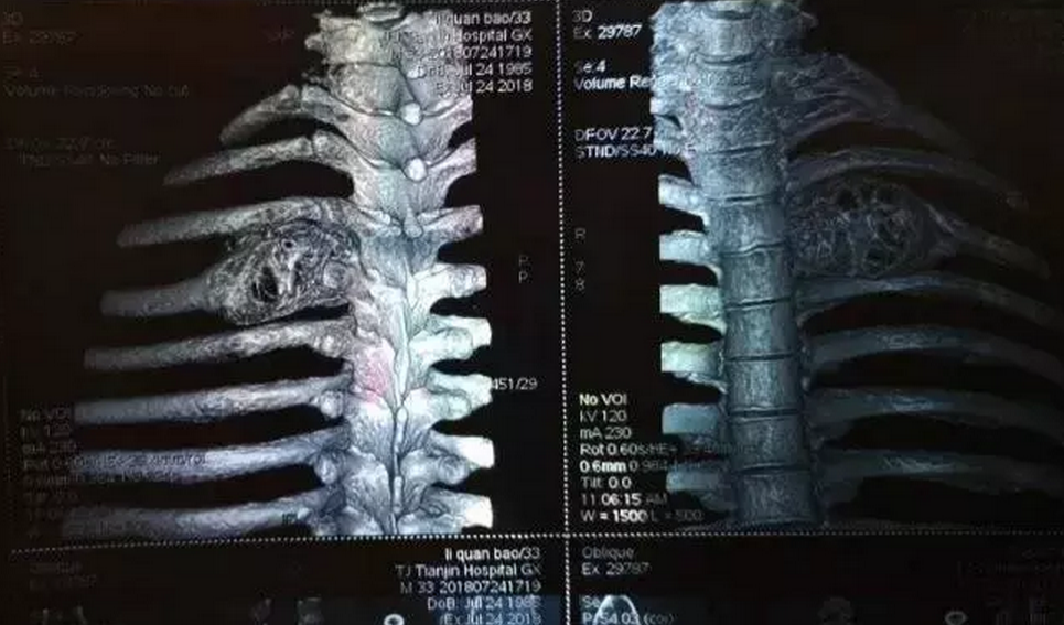 微信图片_20190116000620.png